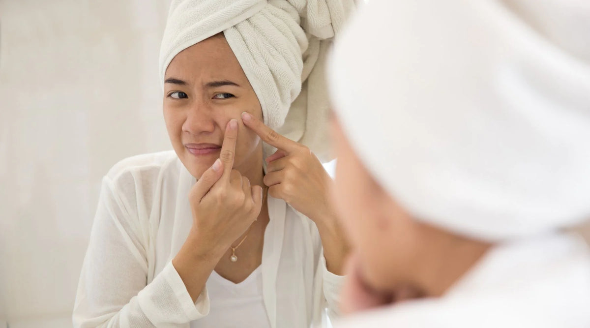 WHAT DIFFERENT TYPES OF ACNE MEAN