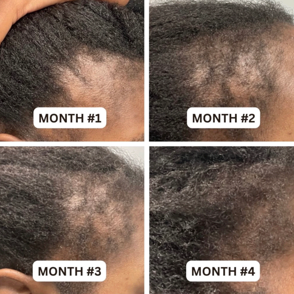 hair growth oil - gif